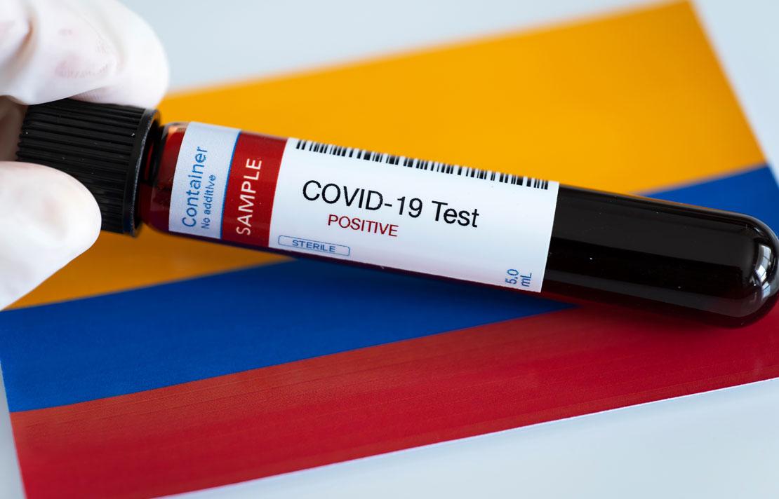 Fotografía, Tubo de ensayo con el nombre "Covid Test"