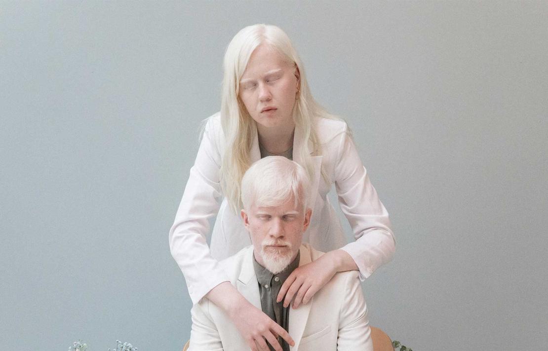 frente a un fondo gris aparecen dos personas albinas, los dos visten de color blanco, al frente está uno sentado, atrás de pie hay una mujer abrazándolo